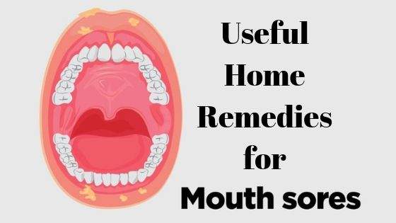 Useful Home Remedies for Oral Cancer