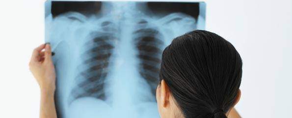 Buying the best Medical X ray film