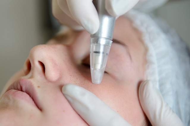 Microdermabrasion Products