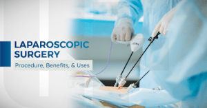 Laparoscopy_ Procedure