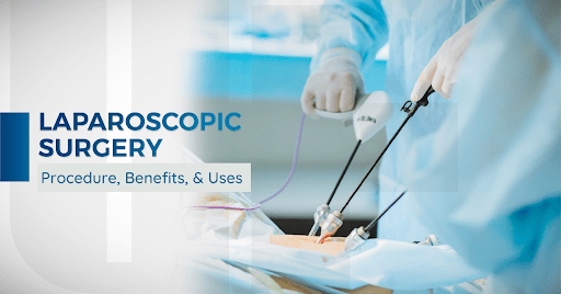 Laparoscopy: Procedure, Benefits, & Uses