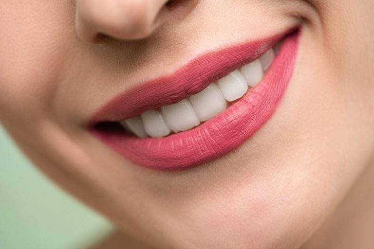 6 Things You Can do to Improve the Appearance of Your Teeth