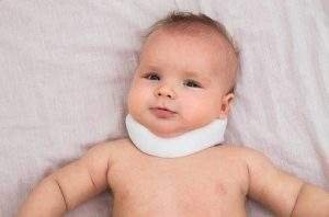 torticollis-2